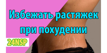 Как избежать растяжек при похудении: 12 шагов Как избежать растяжек при похудении: 12 шагов