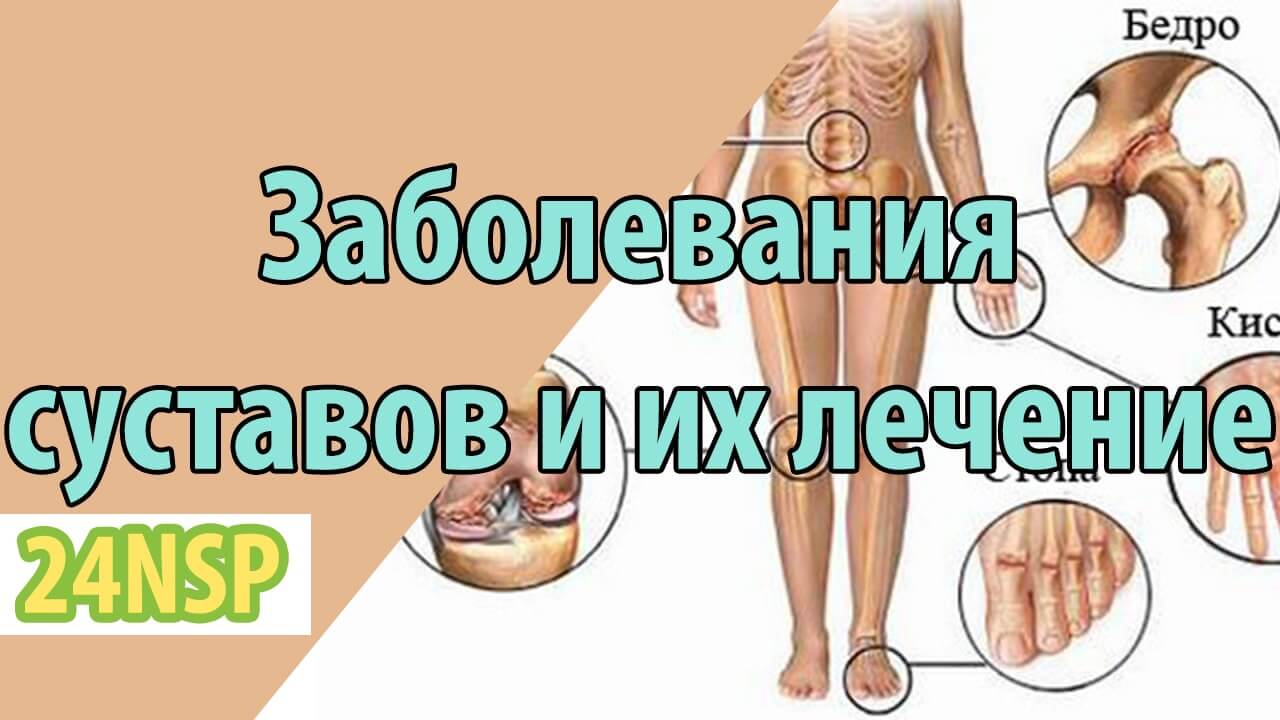 Заболевания суставов и их лечение продукцией NSP