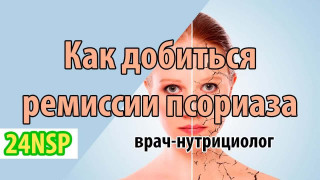 Как добиться ремиссии при псориазе! (Видео-лекция)