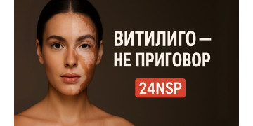 Как и чем помочь при витилиго Как и чем помочь при витилиго
