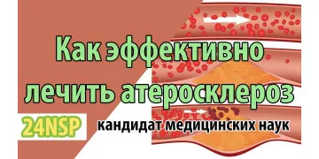 Как эффективно лечить атеросклероз сосудов? Атеросклероз - симптомы и причины! ✓Лекция от к.м.н. Как эффективно лечить атеросклероз сосудов? Атеросклероз - симптомы и причины! ✓Лекция от к.м.н.